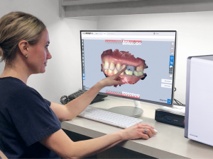Glidewell Dental System- Scanner